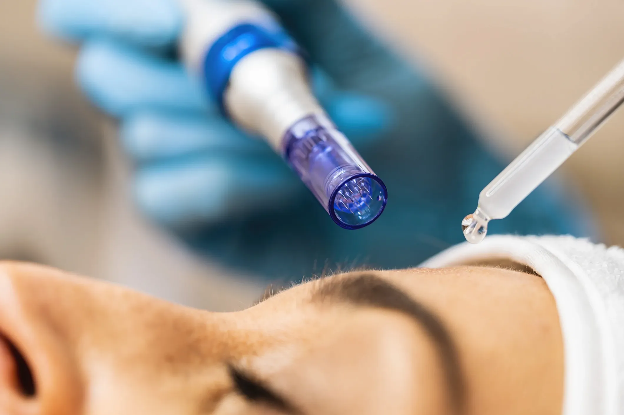 Microneedling with Led Light Therapy